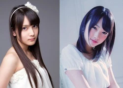 2 thành viên AKB48 bị chém trọng thương, phải phẫu thuật gấp