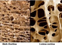 Bí quyết bổ sung canxi theo từng lứa tuổi