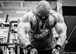 Da đầu gấp nếp như não người do lạm dụng steroid