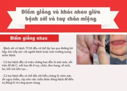 Điểm giống và khác nhau giữa bệnh sởi và tay chân miệng