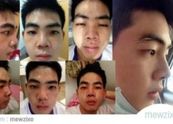 Nam sinh 19 tuổi thẩm mỹ 10 lần để thành hot boy