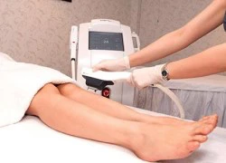 Nên waxing hay triệt lông bằng ánh sáng?