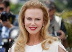 'Thiên nga Úc' Nicole Kidman lộ mặt biến dạng sưng phồng vì thẩm mỹ