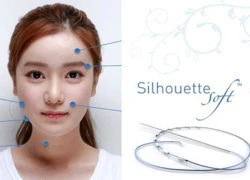 Trẻ hóa toàn diện khuôn mặt với Silhouette Lift