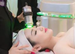 Trị mụn với công nghệ Green Laser hiện đại