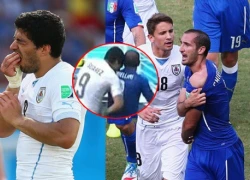 Ảnh Suarez cắn Chiellini hot nhất tuần