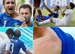 Luis Suarez mất gì sau vụ "cẩu xực" tai tiếng