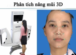 Quy trình nâng mũi kiểu Hàn Quốc