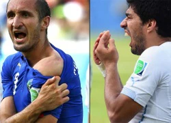 Suarez lần thứ ba cắn đối thủ