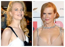 Vòng một to nhỏ thất thường của Nicole Kidman