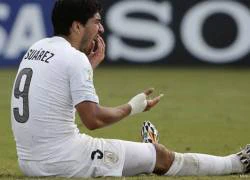 Hé lộ điều khoản &#8216;cấm cắn&#8217; giữa Braca và Luis Suarez