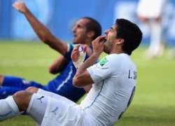 Suarez chỉ chạm môi, chứ không cắn Chiellini