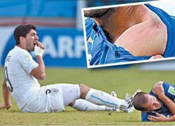 Suarez nói gì về hành động "cẩu xực" với Chiellini?