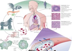 Cách phòng ngừa bệnh lây truyền Ebola chết người