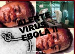 Dấu hiệu nhận biết sớm người nhiễm Ebola trong thời gian ủ bệnh