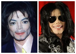 Gương mặt biến đổi theo thời gian của Michael Jackson