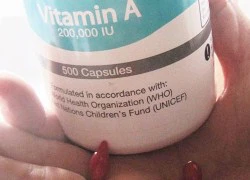 Khi nào thì cơ thể cần bổ sung các loại vitamin?