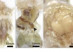 Kỹ thuật mới: Làm cơ thể trong suốt để chữa bệnh