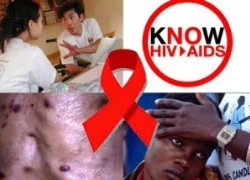 Mỗi tháng phát hiện mới 868 người nhiễm HIV