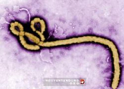 Một bệnh nhân Canada nghi mắc bệnh Ebola bị cách ly