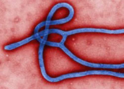 Nguy cơ Ebola vào Việt Nam tăng dần