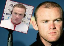 Rooney thành "Đội trưởng Botox"