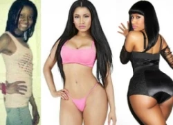 Sự khác biệt khó tin của Nicki Minaj trước khi &#8216;độn&#8217; nhựa toàn thân