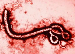 Sự khác nhau giữa Ebola và sốt xuất huyết đang lưu hành ở nước ta