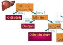 Viêm gan C: Ai dễ mắc căn bệnh 'sát thủ thầm lặng' này?