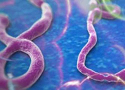 Việt Nam không cần nhờ nước ngoài xét nghiệm Ebola