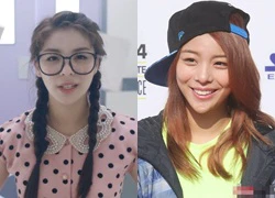 Ca sĩ Hàn Ailee lộ cằm nhọn hoắt đáng ngờ