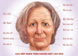 Làm đẹp với botox