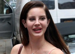 Lana Del Rey mặt cứng đờ do phẫu thuật thẩm mỹ