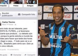 Ronaldinho bị chính trị gia Mexico gọi là &#8216;con khỉ&#8217;