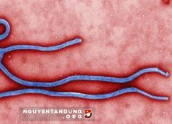 Tranh cãi về nguy cơ Ebola biến dạng lây qua không khí