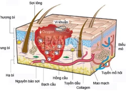 Cách đặc trị hôi nách cho phái mạnh