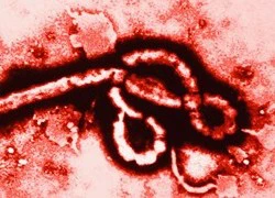 Cảnh báo nguy cơ Ebola toàn cầu sau ca lây nhiễm thứ 2 tại Mỹ