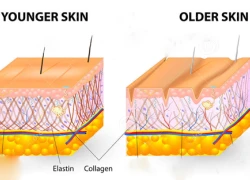 Lý do làn da bị già trước tuổi