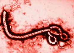 Một nửa số dân Mỹ hiểu lầm về Ebola