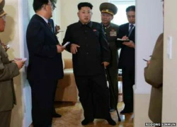 Nhà lãnh đạo Kim Jong-un bất ngờ chống gậy tái xuất