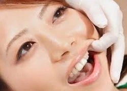 Những nguyên nhân khiến bạn bị đau răng