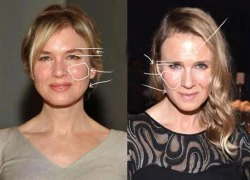 Renee Zellweger bị nghi 'dao kéo' vì gương mặt khác lạ