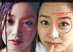 Rộ nghi vấn Kim Tae Hee sửa mắt, nâng ngực