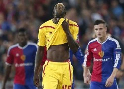 Sốc: &#8220;Bé hư&#8221; Balotelli sa sút phong độ vì&#8230;lợn cưng