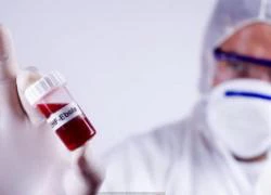 Thái Lan: Phát triển thành công kháng thể điều trị bệnh Ebola