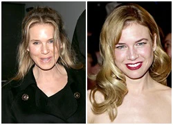 Gương mặt biến đổi theo thời gian của Renee Zellweger