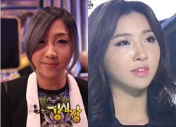 Minzy (2NE1) bị nghi phẫu thuật thẩm mỹ cùng chỗ với Park Bom