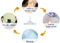 Trị hôi nách sau một lần điều trị