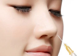 3 ưu điểm khi nâng mũi bằng filler