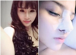 Hành trình 'cứu nguy nhan sắc' cho Trang Venus